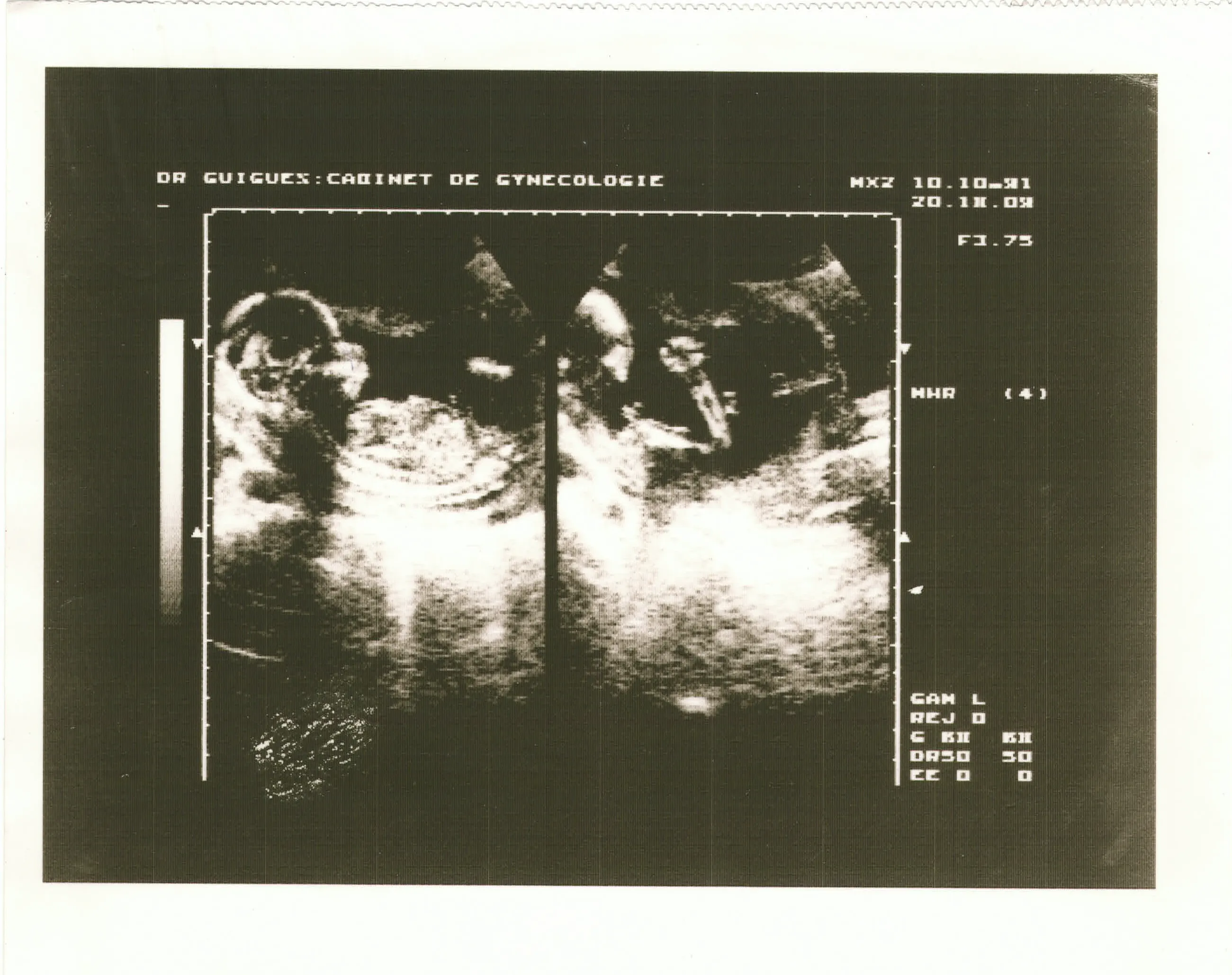 Photo 01